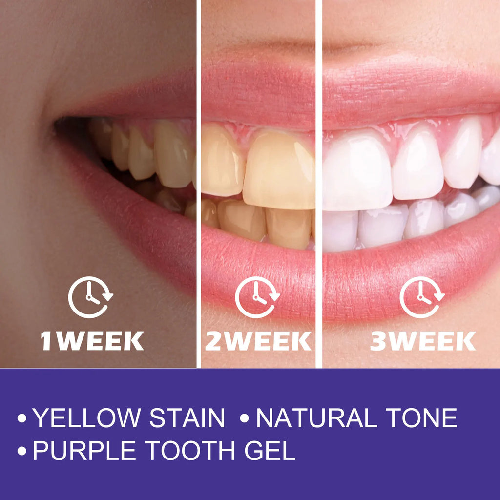 Purple whitening toothpaste, deep cleaning, stain removal, fresh breathing, daily household essential oral care, 30ml